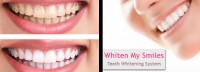 64% Off Teeth Whitening Session at Whiten My Smiles in Nanaimo! ?>